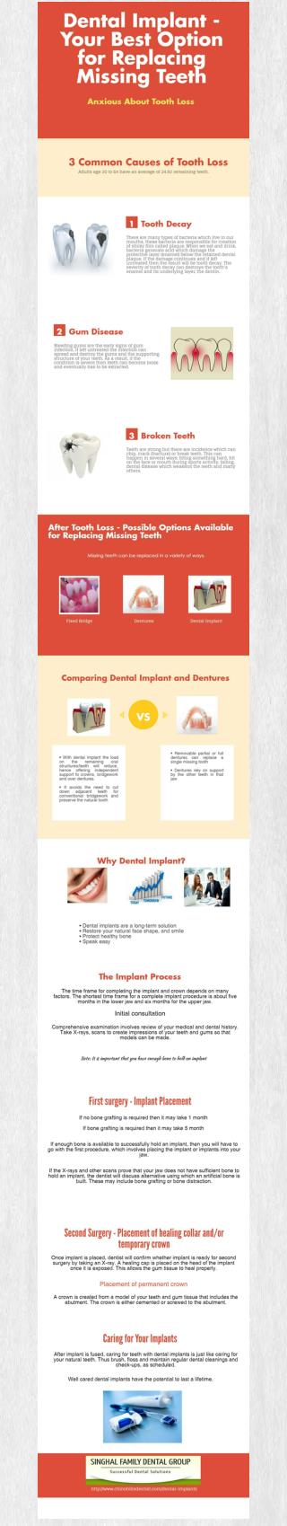 Dental Implant - Your Best Option for Replacing Missing Teeth