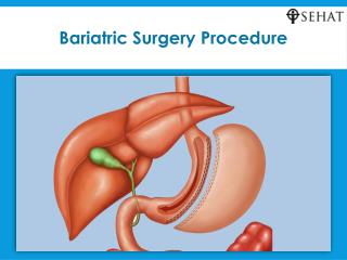 Bariatric surgery procedure