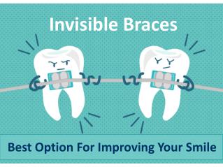 Best Option For Improving Your Smile - Invisible Braces
