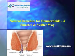 Natural remedies for hemorrhoids - A smarter & swifter way