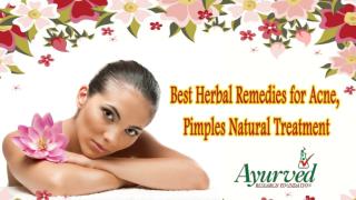 Best Herbal Remedies for Acne, Pimples Natural Treatment