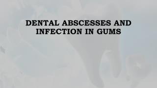 Dental Abscesses and Infection in Gums
