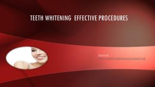 Teeth Whitening Effective Procedures