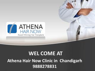 Athena Hair Now-Hair Transplant Clinic in Chandigarh