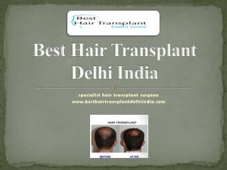 Best Hair Transplant FUE, FUT, Eyebrow Delhi, Hair Loss Treatment India