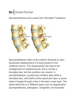 Spondylolisthesis and Lumbar Disc Herniation Treatment