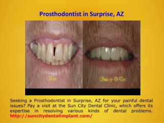 Full Mouth Restoration in Sun City, AZ
