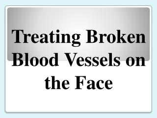 Treating Broken Blood Vessels on the Face