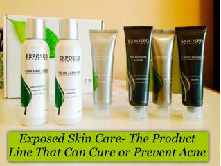 Exposed skin care- the product line that can cure or prevent acne