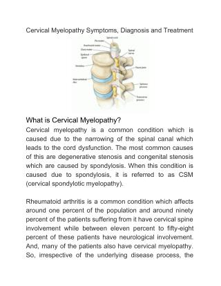 Cervical Myelopathy Symptoms, Diagnosis and Treatment