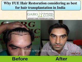 Why FUE Hair Restoration considering as best for hair transplantation in India