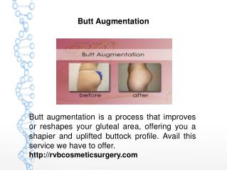 Butt Augmentation