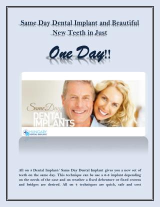Same Day Dental Implant and Beautiful New Teeth in Just One Day!!