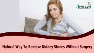 Natural Way To Remove Kidney Stones Without Surgery