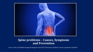 Spine problems – Causes, Symptoms and Prevention
