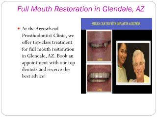 Full Mouth Restoration in Peoria, AZ