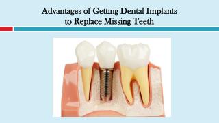 Advantages of Getting Dental Implants to Replace Missing Teeth