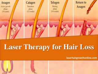 Ultimate Laser Therapy for Hair Loss