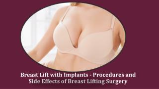Breast Lift with Implants - Procedures and Side Effects of Breast Lifting Surgery