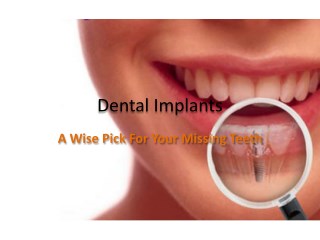 Dental Implants - A Wise Pick For Your Missing Teeth