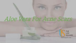 Aloe Vera For Acne Scars