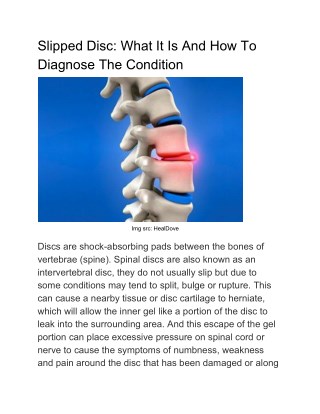 Slipped Disc: What It Is And How To Diagnose The Condition