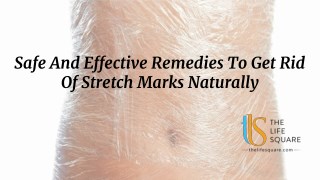 Safe And Effective Remedies To Get Rid Of Stretch Marks Naturally
