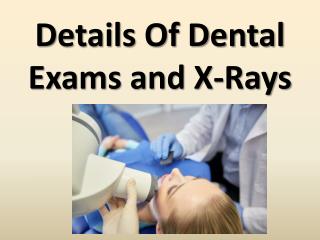 Details Of Dental Exams and X-Rays