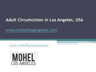 Adult Circumcision in Los Angeles, USA - www.mohellosangeles.com