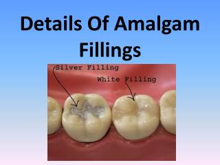 Details Of Amalgam Fillings
