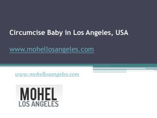 Circumcise Baby in Los Angeles, USA - www.mohellosangeles.com