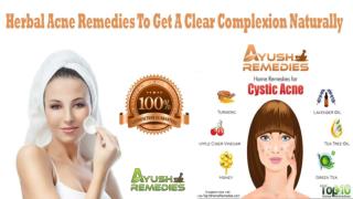 Herbal Acne Remedies To Get A Clear Complexion Naturally