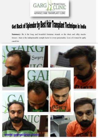 Get Back of Splendor by Best Hair Transplant Technique in India