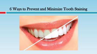 Ways to Prevent and Minimize Tooth Staining