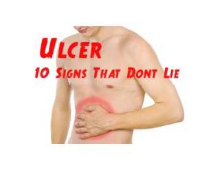 How To Get Rid Of Stomach Ulcers, Bacteria H Pylori, Medicine For H Pylori, Ulcer Healing