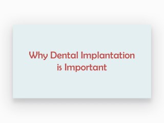 Why Dental Implantation is Important