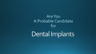 Are You A Probable Candidate for Dental Implants?