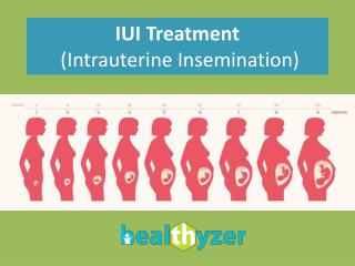 Find Hospitals for IUI Treatment in India at Healthyzer.com