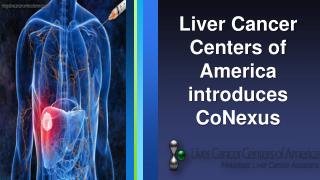 Liver Cancer Centers of America introduces CoNexus