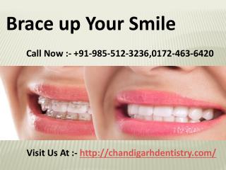 Orthodontic Treatment in Chandigarh