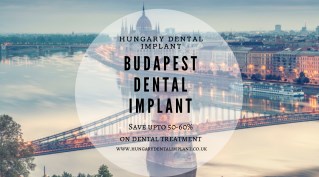 Dental Implant in Budapest