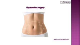 About Liposuction Surgery