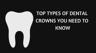 TOP TYPES OF DENTAL CROWNS YOU NEED TO KNOW