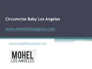 Circumcise Baby Los Angeles - www.mohellosangeles.com