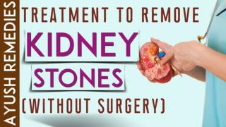 Kidney Stone Treatment without Surgery to Remove Stones in Home