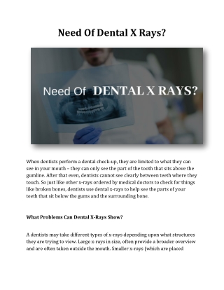 Need Of Dental X Rays?