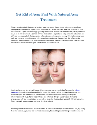 Get Rid of Acne Fast With Natural Acne Treatment