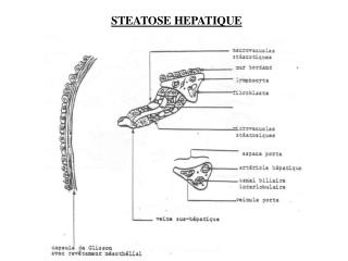 STEATOSE HEPATIQUE
