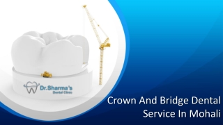 Best Crown and Bridge Dental Service in Mohali