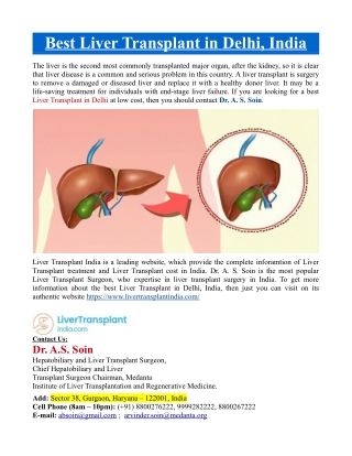 Best Liver Transplant in Delhi, India